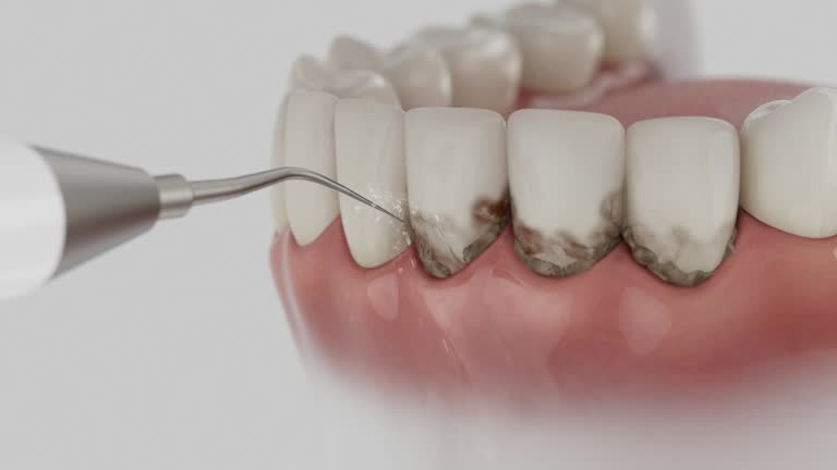 Reliable Dental contractor in Flora, IN by Smile Center Dentistry